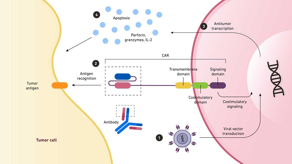 A diagram showing how CAR T-cell therapy works at a cellular level.
