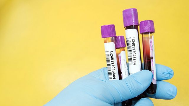 Blood test vials held in a gloved hand. 