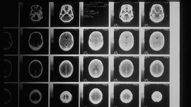 Brain scans. 